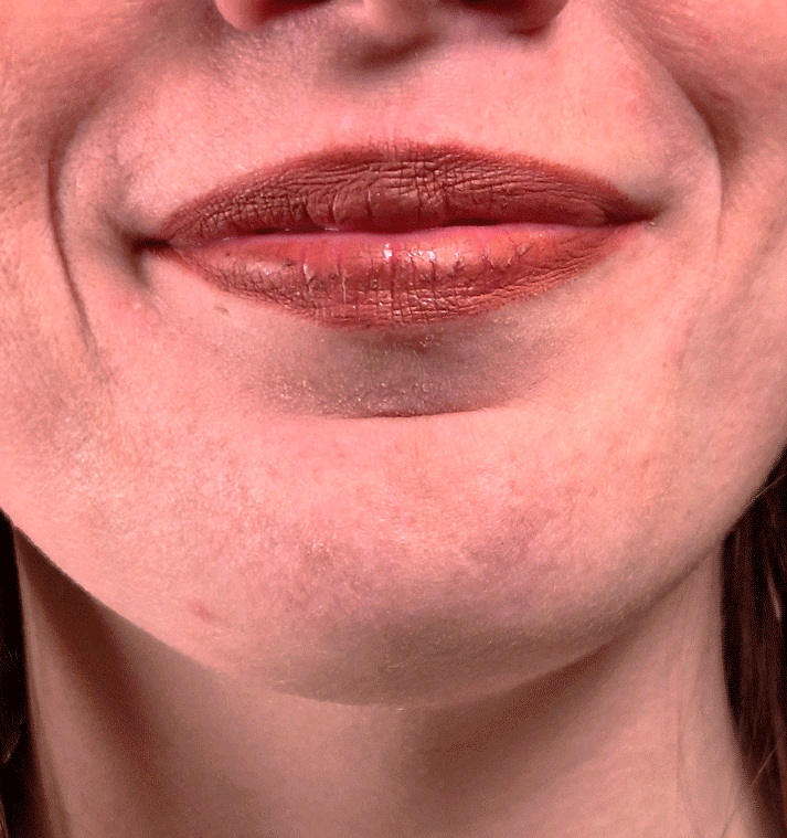 Mirakelbær - pakke med 15 stk enkeltbær